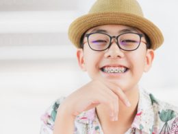 How Much Are Braces in Ontario? - Dental Braces