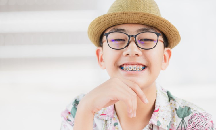 How Much Are Braces in Ontario? - Dental Braces