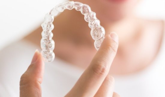 Self Ligating Braces