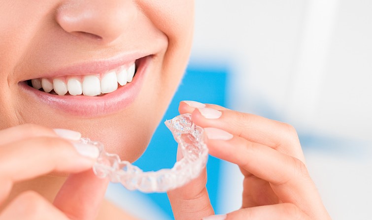 What is Invisalign? & How Much Are Invisalign in Canada?