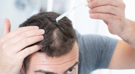 SCALP MICROPIGMENTATION