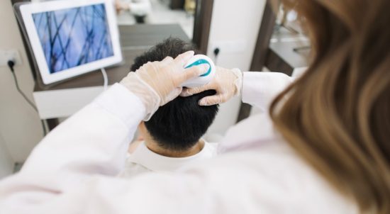 SCALP MICROPIGMENTATION FOR SCARRING ALOPECIA