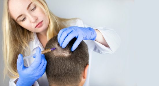 SCARRING ALOPECIA